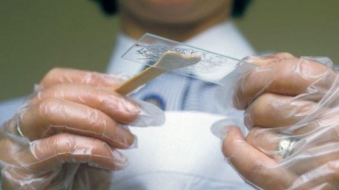 Bagaimana Jika Pap Smear Menunjukkan Hasil Positif? Begini Tanggapan dr. Yuniar, Sp.OG