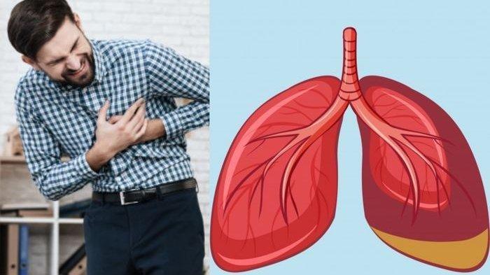 PPOK pada Perokok Aktif Memiliki Dampak Rasa Sesak Terus Menerus