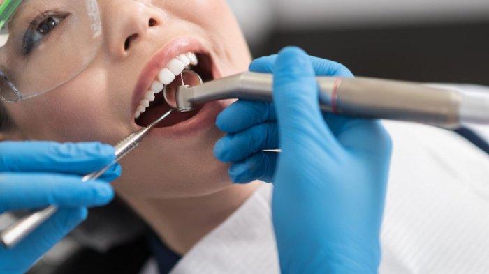 Dokter Gigi Sebut Scaling Gigi Menjadi Upaya yang Dapat Dilakukan untuk Pengobatan Gingivitis