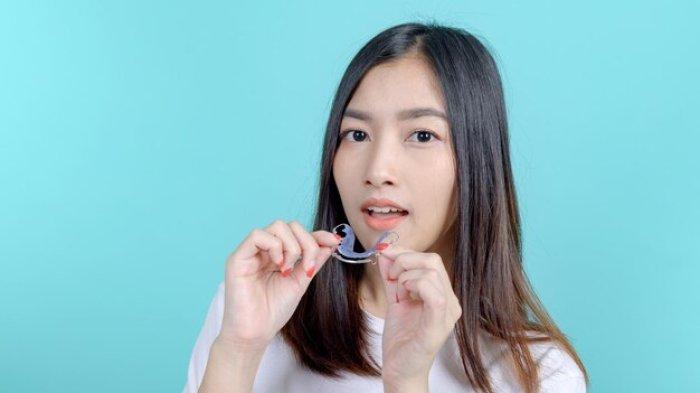 5 Fakta Seputar Retainer Gigi, Harus Digunakan setelah Pasang Behel agar Gigi Tak Berantakan Lagi