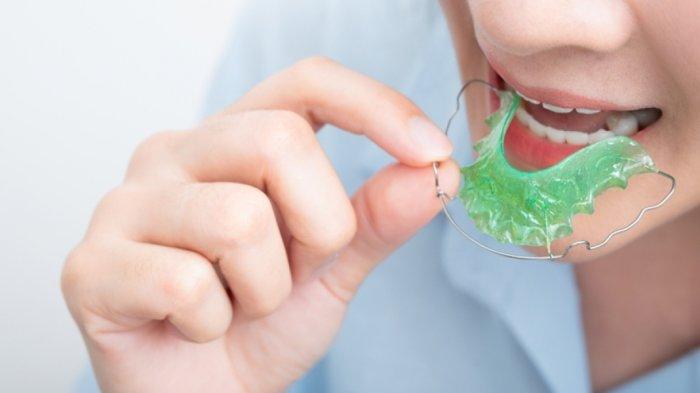 Sebelumnya Tidak Menggunakan Behel apakah Diperbolehkan Menggunakan Retainer? Ini Kata Dokter