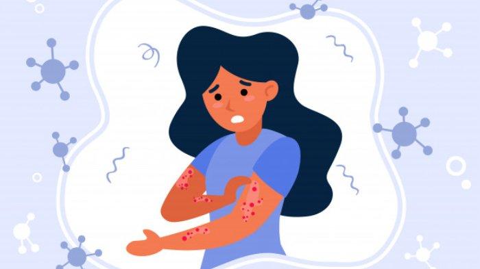 Mengenal Penyakit Scleroderma yang Menyerang Beberapa Organ Tubuh