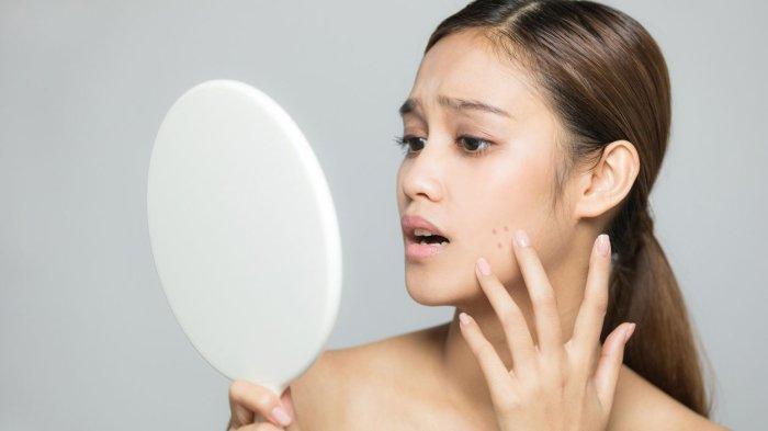 ilustrasi seseorang yang mengalami masalah kerusakan pada skin barrier