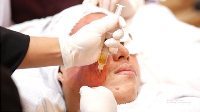 Dokter, Apakah Pria Boleh Melakukan Vampire Facial?