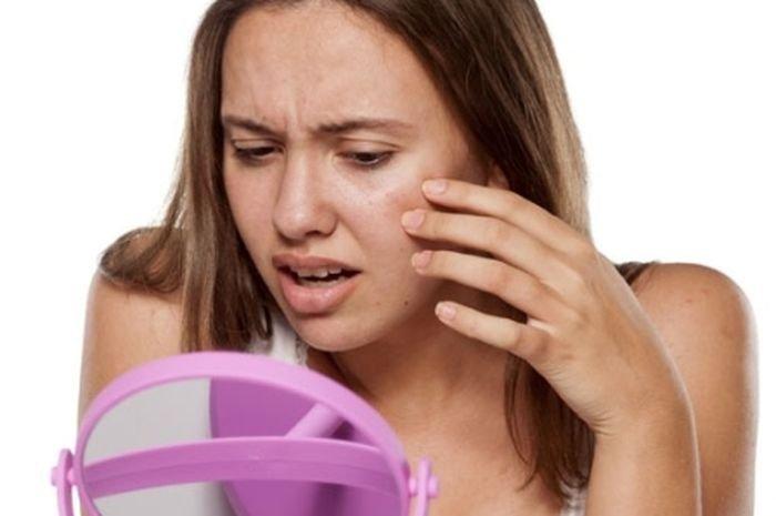 ilustrasi seseorang yang memiliki warna kulit wajah tidak merata