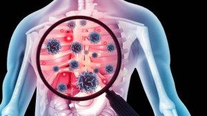 ilustrasi-pasien-tuberkulosis-tbc-begini-penuturan.jpg