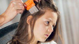 kutu-rambut-7.jpg