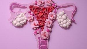pcos-8.jpg
