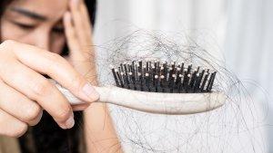 rambut-rontok-9.jpg