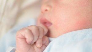 ruam-pada-pipi-bayi_12.jpg