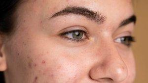 skin-barrier-8.jpg