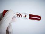 HIV-12.jpg