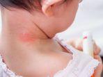 alergi-pada-bayi-1.jpg
