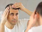 alopecia-11.jpg