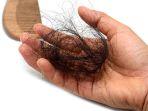 alopecia-3.jpg