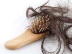 alopecia-5.jpg