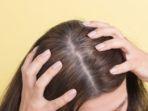 alopecia-8.jpg