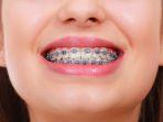 behel-14.jpg