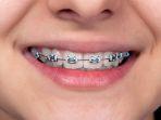 behel-17.jpg