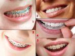 behel-24.jpg