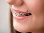 behel-35.jpg