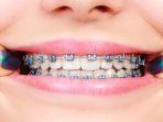 behel-36.jpg
