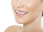 behel-40.jpg
