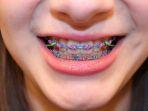 behel-43.jpg