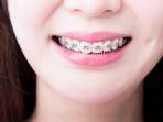behel-44.jpg