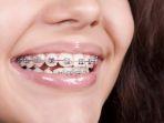 behel-45.jpg