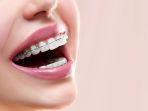 behel-46.jpg