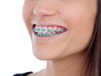 behel-5.jpg