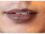 bibir-hitam-1.jpg