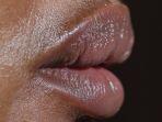 bibir-hitam.jpg