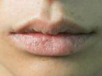bibir-kering-1.jpg