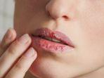 bibir-kering-3.jpg