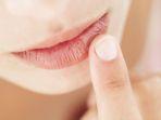 bibir-kering-4.jpg