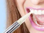 bleaching-gigi-12.jpg