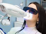 bleaching-gigi-14.jpg