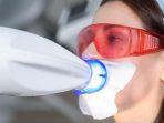 bleaching-gigi-15.jpg