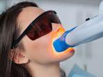 bleaching-gigi-16.jpg