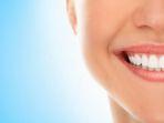 bleaching-gigi-2.jpg