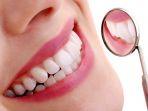 bleaching-gigi-8.jpg