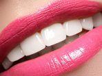 bleaching-gigi-9.jpg