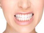bruxism-7.jpg
