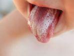 burning-mouth-syndrome.jpg