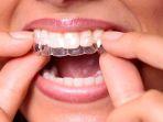 clean-aligner-1.jpg