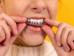 clean-aligner.jpg