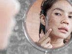 dampak-negatif-penggunaan-steroid-pada-wajah.jpg