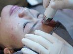 dermapen-1.jpg